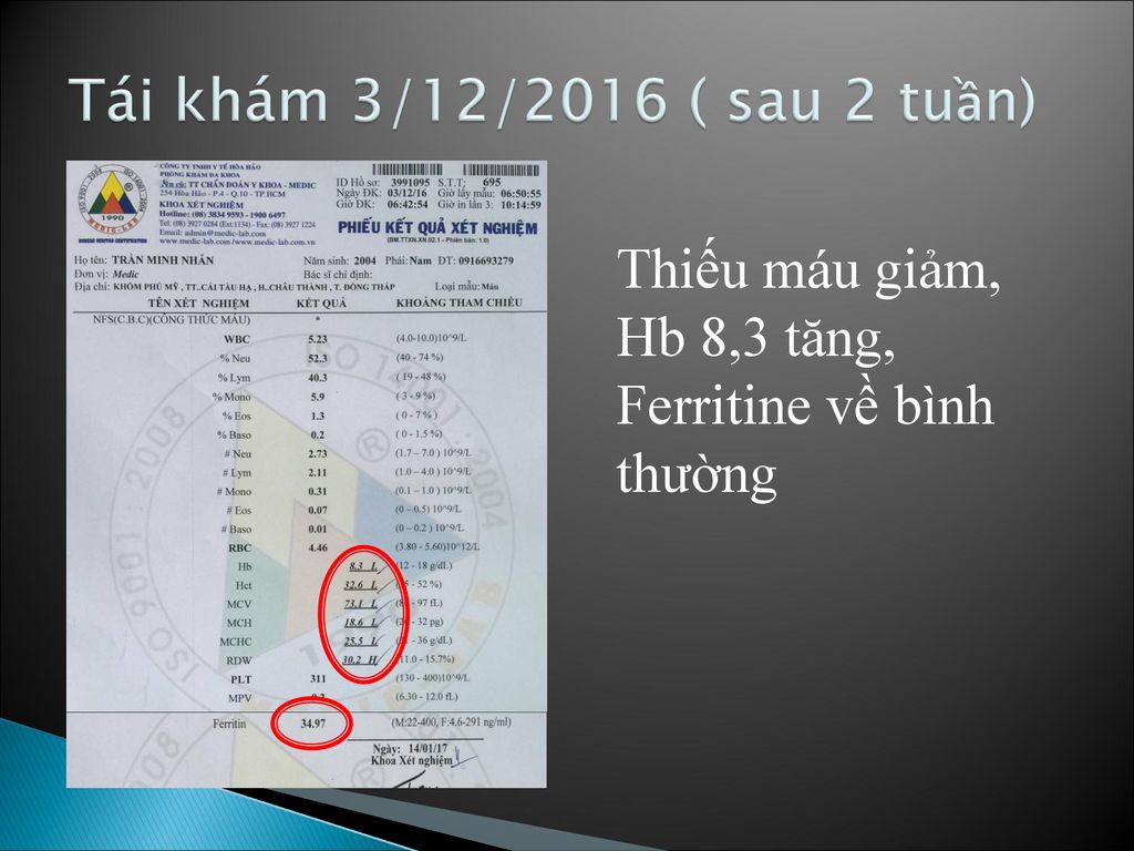 Tái khám 3/12/2016 ( sau 2 tuần) Thiếu máu giảm, Hb 8,3 tăng, Ferritine về bình thường