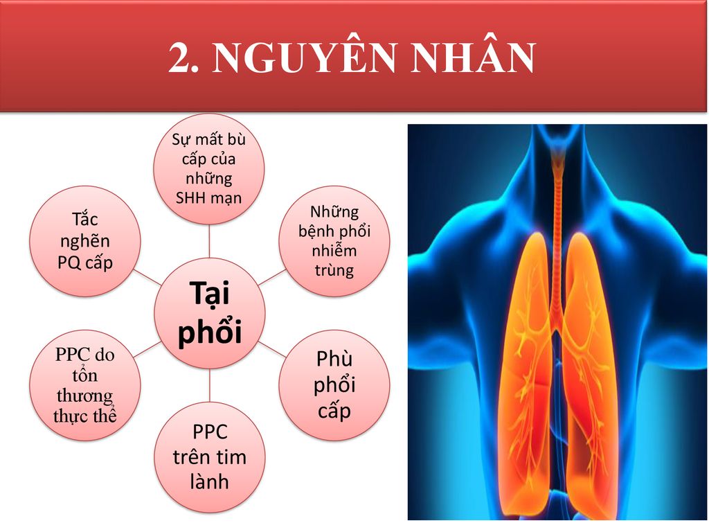 2. NGUYÊN NHÂN Tại phổi Phù phổi cấp PPC trên tim lành