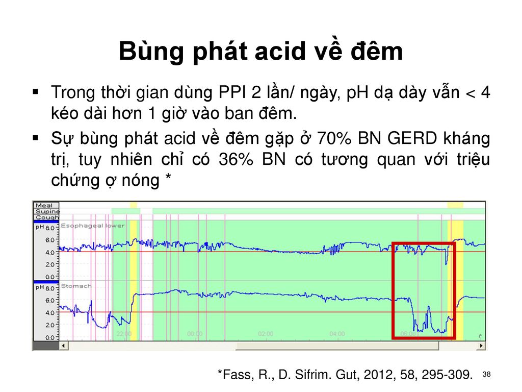 Bùng phát acid về đêm Trong thời gian dùng PPI 2 lần/ ngày, pH dạ dày vẫn < 4 kéo dài hơn 1 giờ vào ban đêm.